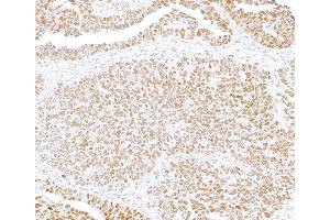 Immunohistochemistry (IHC) image for anti-SWI/SNF Related, Matrix Associated, Actin Dependent Regulator of Chromatin, Subfamily B, Member 1 (SMARCB1) (AA 225-275) antibody (ABIN7795717)