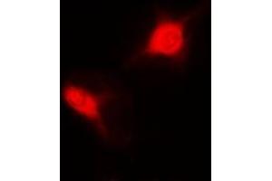 anti-Small Nuclear Ribonucleoprotein D2 Polypeptide 16.5kDa (SNRPD2) antibody