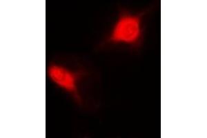 Immunofluorescent analysis of Sm-D2 staining in MCF7 cells. (SNRPD2 anticorps)