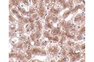 Immunohistochemistry of CUEDC1 in human liver tissue with CUEDC1 antibody at 2 μg/ml.