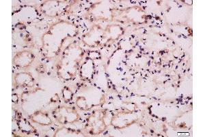 Formalin-fixed and paraffin embedded human kidney labeled with Anti-GRB10/14 Polyclonal Antibody, Unconjugated  at 1:100 followed by conjugation to the secondary antibody and DAB staining. (GRB10/14 (AA 501-594) anticorps)