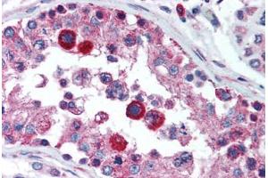 Human Testis (formalin-fixed, paraffin-embedded) stained with HAVCR1 antibody ABIN292373 at 5 ug/ml followed by biotinylated goat anti-rabbit IgG secondary antibody ABIN481713, alkaline phosphatase-streptavidin and chromogen. (HAVCR1 anticorps  (N-Term))