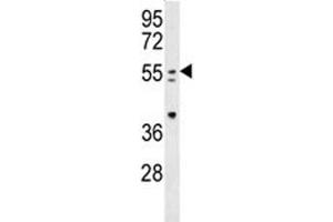 PAX-7 antibody western blot analysis in mouse spleen tissue lysate