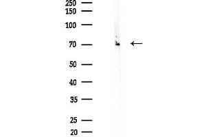 Western blot analysis of lysates from A2780 cells(UV,30 min treatment), using Phospho-CD50/ICAM-3 (Ser518) Antibody at 1/1000 dilution.