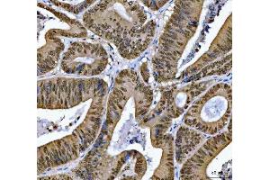 IHC analysis of SNRPN using anti-SNRPN antibody (ABIN3043934). (SNRPN anticorps  (N-Term))