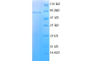 SDS-PAGE (SDS) image for Histone Deacetylase 3 (HDAC3) (AA 1-428), (full length) protein (His-SUMO Tag) (ABIN5709651) (HDAC3 Protein (AA 1-428, full length) (His-SUMO Tag))