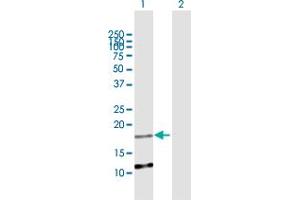 Western Blot analysis of C2orf28 expression in transfected 293T cell line by C2orf28 MaxPab polyclonal antibody. (ATRAID anticorps  (AA 1-171))