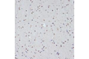Immunohistochemistry of paraffin-embedded mouse brain using Phospho-CDK1-Y15 antibody (ABIN3019442, ABIN3019443, ABIN3019444 and ABIN6225371) at dilution of 1:100 (40x lens). (CDK1 anticorps  (pTyr15))