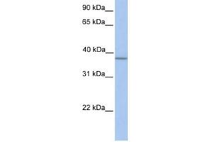 A4GNT antibody used at 1 ug/ml to detect target protein.
