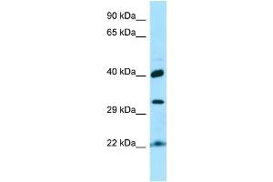 WB Suggested Anti-KTI12 Antibody Titration: 1. (KTI12 anticorps  (C-Term))