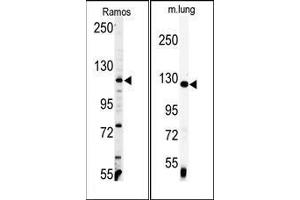 (LEFT) Western blot analysis of anti-VINC Antibody (C-term) in Ramos cell line lysates (35ug/lane). (Vinculin anticorps  (C-Term))