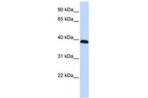 Image no. 1 for anti-Homeobox A10 (HOXA10) (AA 288-337) antibody (ABIN6744392) (HOXA10 anticorps  (AA 288-337))