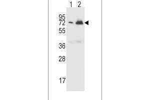 CFHR5 Antibody (Center) (ABIN651876 and ABIN2840434) western blot analysis in CEM(lane 1),K562(lane 2) cell line lysates (15 μg/lane). (CFHR5 anticorps  (AA 203-231))