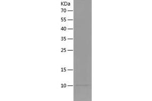 Insulin-Like Growth Factor 1 (IGF1) (AA 49-118) (Active) protein (His tag)