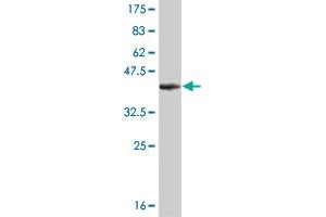 Western Blot detection against Immunogen (36. (KAT2B anticorps  (AA 353-452))