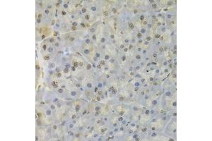 Immunohistochemistry of paraffin-embedded mouse pancreas using HNRNPD Antibody.