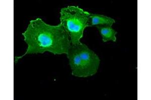 Anti-DFFA mouse monoclonal antibody (ABIN2452370) immunofluorescent staining of COS7 cells transiently transfected by pCMV6-ENTRY DFFA (RC202879). (DFFA anticorps)