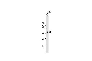 Anti-ARPC1B Antibody (Center) at 1:1000 dilution + Hela whole cell lysate Lysates/proteins at 20 μg per lane. (ARPC1B anticorps  (AA 159-188))