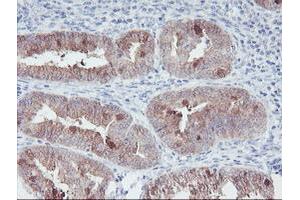 Image no. 12 for anti-Interferon Regulatory Factor 6 (IRF6) antibody (ABIN1498901)