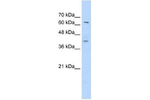 Western Blot showing ZNF415 antibody used at a concentration of 1-2 ug/ml to detect its target protein. (ZNF415 anticorps  (C-Term))