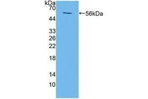 Detection of Recombinant TMEM27, Mouse using Polyclonal Antibody to Transmembrane Protein 27 (TMEM27)
