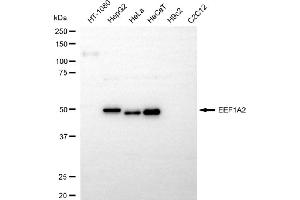 Western blotting analysis using EEF1A2 antibody (ABIN7798499).