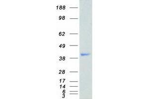 Validation with Western Blot