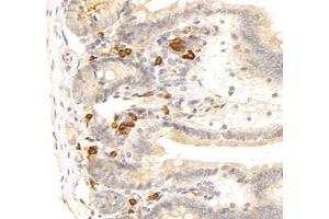 Immunohistochemistry analysis of paraffin-embedded mouse duodenum using,STC (ABIN7075723) at dilution of 1: 800