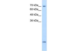 Western Blotting (WB) image for anti-Solute Carrier Family 6 (Neurotransmitter Transporter, Creatine), Member 8 (SLC6A8) antibody (ABIN2462555) (SLC6A8 anticorps)