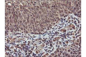 Image no. 4 for anti-V-Akt Murine Thymoma Viral Oncogene Homolog 1 (AKT1) antibody (ABIN1496554) (AKT1 anticorps)