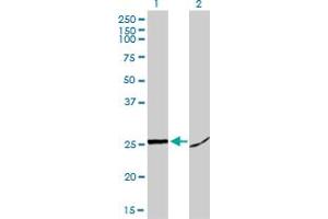 Western Blot analysis of HMGB1 expression in transfected 293T cell line by HMGB1 monoclonal antibody (M02), clone 1D5. (HMGB1 anticorps  (AA 1-215))