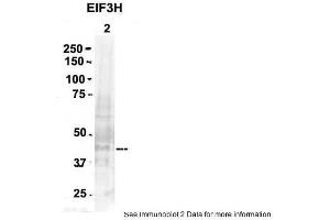 Sample Type: 2. (EIF3H anticorps  (N-Term))
