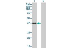 Western Blot analysis of RHOXF2 expression in transfected 293T cell line by RHOXF2 MaxPab polyclonal antibody. (RHOXF2 anticorps  (AA 1-288))