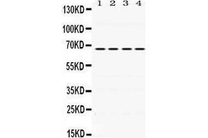 Western Blotting (WB) image for anti-Nuclear Receptor Subfamily 4, Group A, Member 1 (NR4A1) (AA 372-408), (C-Term) antibody (ABIN3043576)