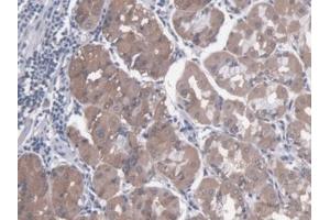 Detection of PKN1 in Human Stomach Tissue using Polyclonal Antibody to Protein Kinase N1 (PKN1)