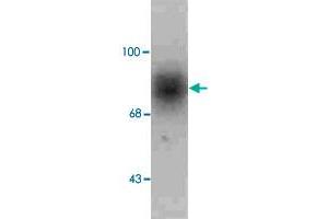 Western blot of human caudate lysate showing specific immunolabeling of the ~88k SLC6A3 protein.