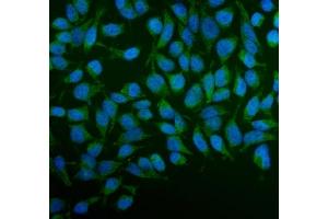 IF analysis of PFKFB2 using anti-PFKFB2 antibody (ABIN7601627). (PFKFB2 anticorps  (AA 4-505))