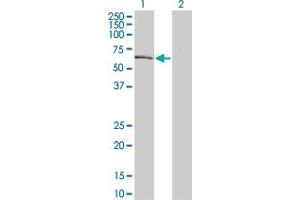 Western Blot analysis of DYRK2 expression in transfected 293T cell line by DYRK2 monoclonal antibody (M02), clone 6E2. (DYRK2 anticorps  (AA 1-100))