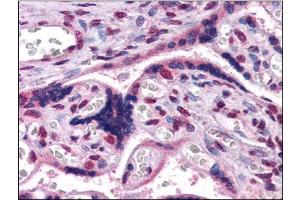 Immunohistochemistry Image: Human Placenta: Formalin-Fixed, Paraffin-Embedded (FFPE) (GBX2 anticorps  (Internal Region))