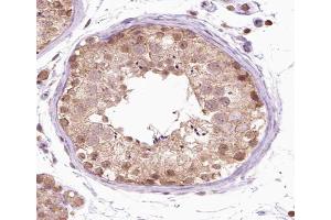 ABIN6266538 at 1/100 staining human testis tissue sections by IHC-P. (FGFR1OP anticorps  (C-Term))