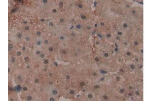 Detection of GPX4 in Human Liver Tissue using Polyclonal Antibody to Glutathione Peroxidase 4 (GPX4)