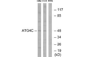 Immunohistochemistry analysis of paraffin-embedded human liver carcinoma tissue using ATG4C antibody. (ATG4C anticorps  (Internal Region))