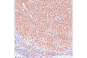 Immunohistochemistry of paraffin-embedded rat ovary using LRP1 antibody (ABIN3021968, ABIN3021969, ABIN3021970 and ABIN6218530) at dilution of 1:100 (40x lens). (LRP1 anticorps  (AA 20-270))