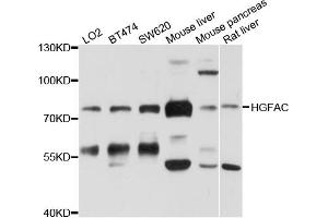 Western blot analysis of extracts of various cell lines, using HGFAC antibody. (HGFA anticorps)
