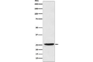 Western blot analysis of Prostaglandin dehydrogenase 1 expression in SW480 cell lysate.