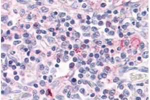 Anti-ROR Gamma antibody  ABIN1049302 IHC staining of human thymus. (RORC anticorps  (Ligand Binding Domain))
