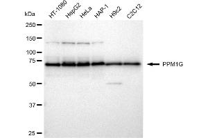 Western blotting analysis using PPM1G antibody (ABIN7800034).