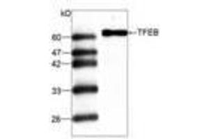 Image no. 1 for anti-Transcription Factor EB (TFEB) antibody (ABIN791477) (TFEB anticorps)