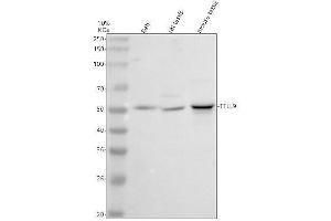 Western blot analysis of TTLL9 using anti-TTLL9 antibody (ABIN7826001).