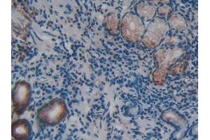 DAB staining on IHC-P; Samples: Human Stomach Tissue